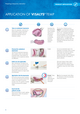Application Visalys Temp step by step