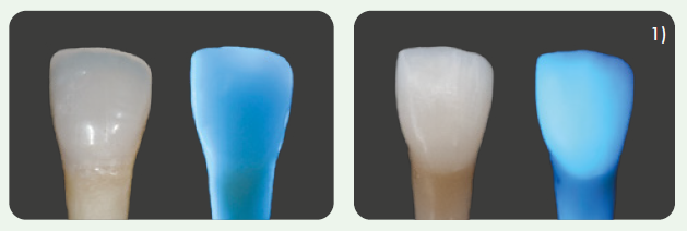 Picture: Translucency/ Opalescence and fluorescence of the VISALYS BIOCERAMIC BLOCK compared to a natural tooth
