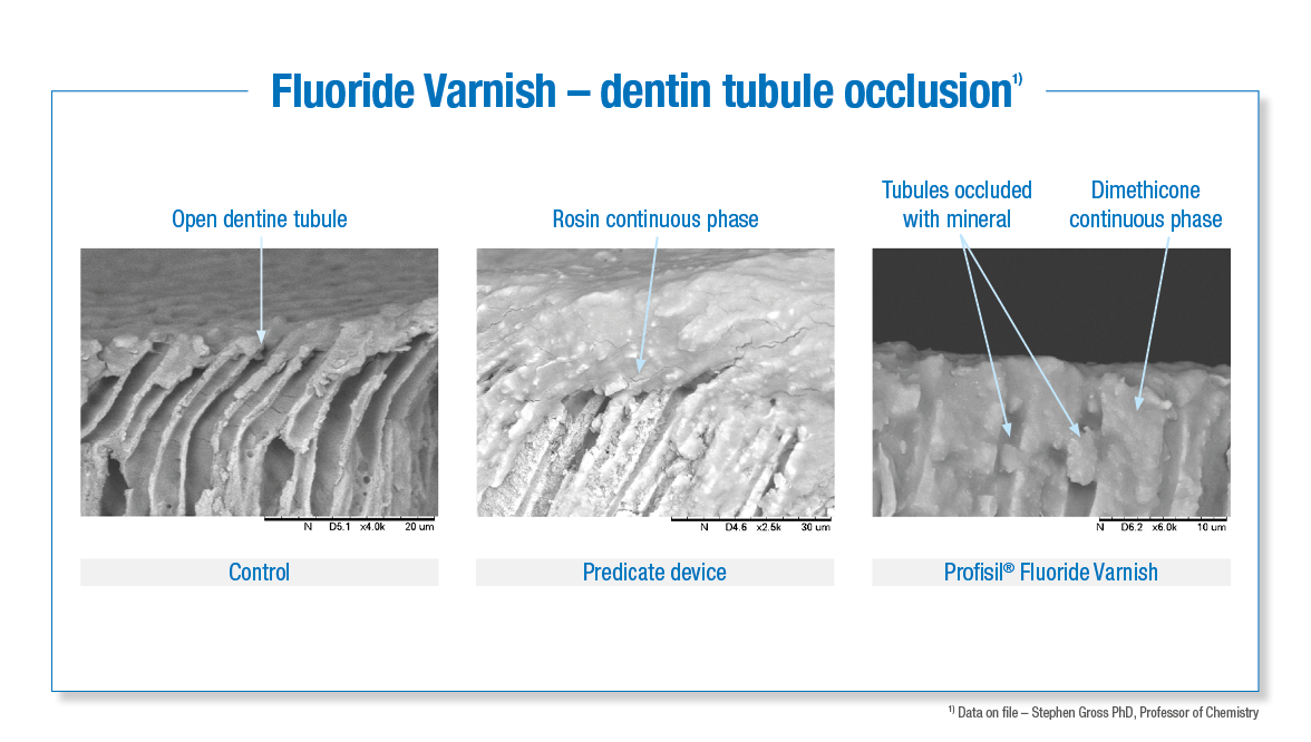 Profisil Kettenbach Dental